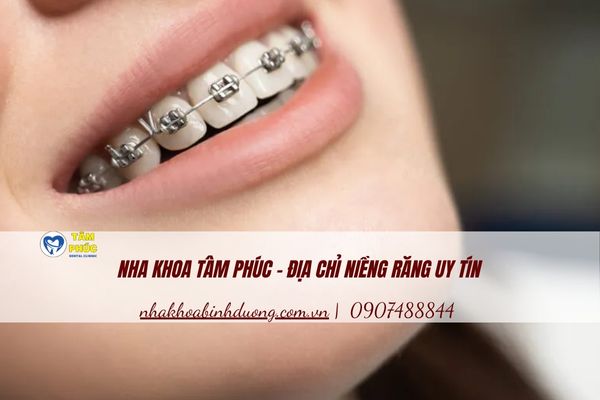 Nha khoa Tâm Phúc