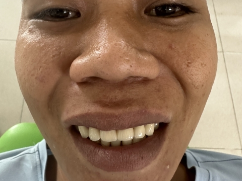 Hình Ảnh Làm Răng Tại Nha Khoa Tâm Phúc