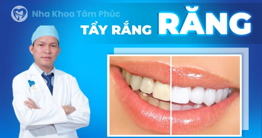 Địa chỉ tẩy trắng răng uy tín, giá tốt ở Bình Dương - Nha Khoa Tâm Phúc