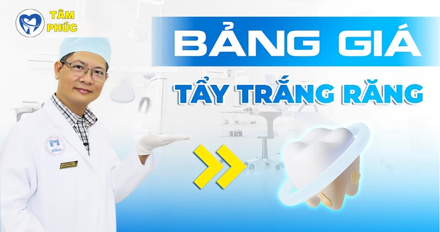 Chi phí tẩy trắng răng