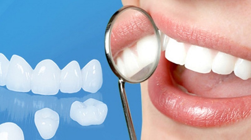 Bọc răng sứ là một phương pháp thẩm mỹ nha khoa giúp cải thiện tình trạng răng bị hư tổn, mất thẩm mỹ. 