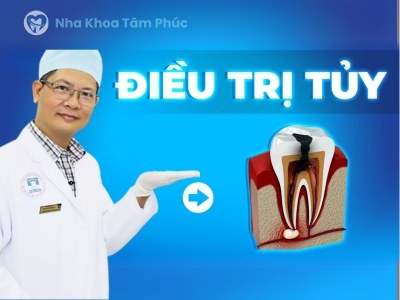 Viêm tủy răng:  Dấu hiệu, nguyên nhân và cách phòng ngừa