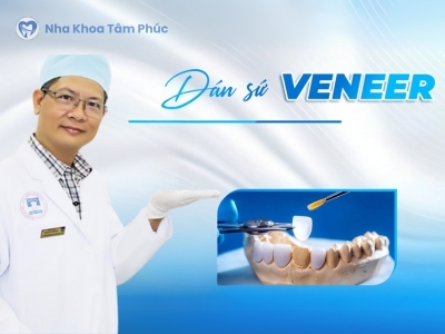  Dán sứ Veneer không mài răng: Giá thành và những điều cần lưu ý
