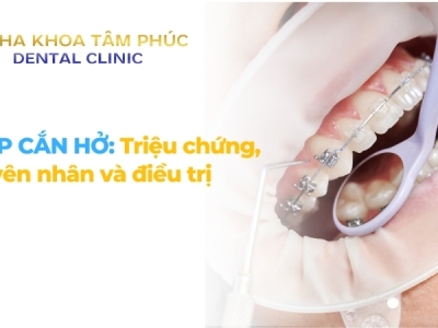 Khớp cắn hở: Nguyên nhân, dấu hiệu, biến chứng và cách điều trị