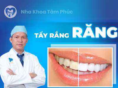 Tẩy trắng răng giá từ 699.000 VNĐ - Bảng giá mới nhất 2025