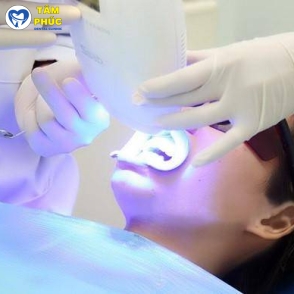 Dịch vụ tẩy trắng răng nha khoa uy tín tại Tâm Phúc